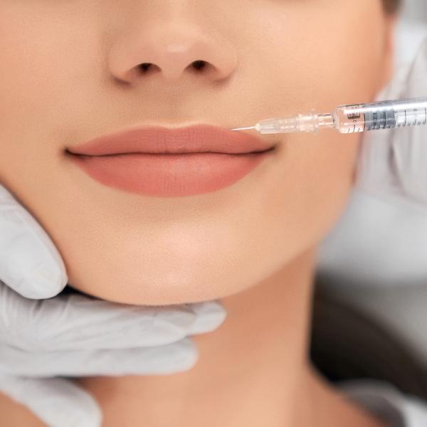 Hyaluron Lippenfiller- Ästhetische Lippen ganz ohne Operation