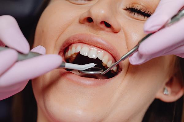 Die häufigsten Ursachen für Zahnverlust und wie man diesen vermeiden kann
