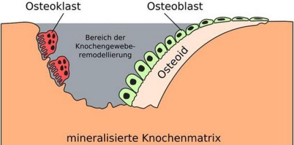 Der Osteoporose natürlich vorbeugen 