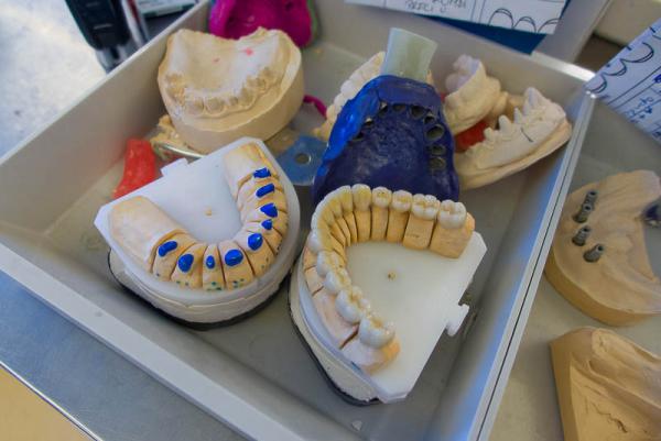 Der Norddeutsche Rundfunk NDR sucht Zahnpatienten aus Norddeutschland für einen TV-Bericht.