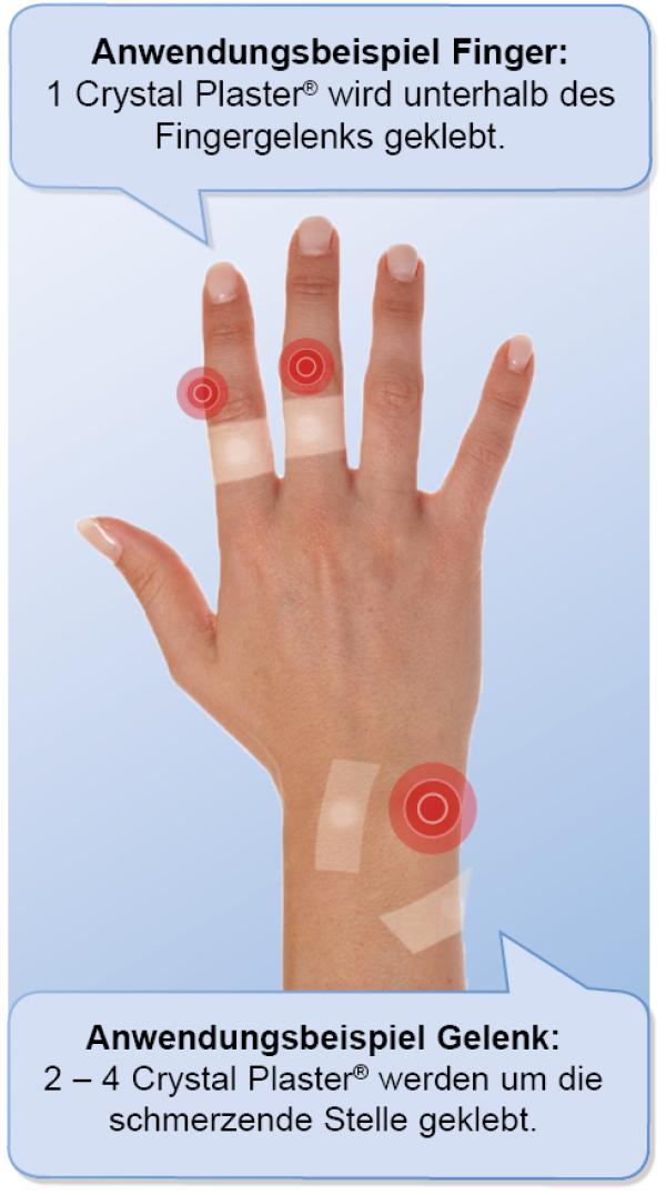 Warum die alte Wärmeflasche bei Schmerzbehandlungen  wieder modern ist