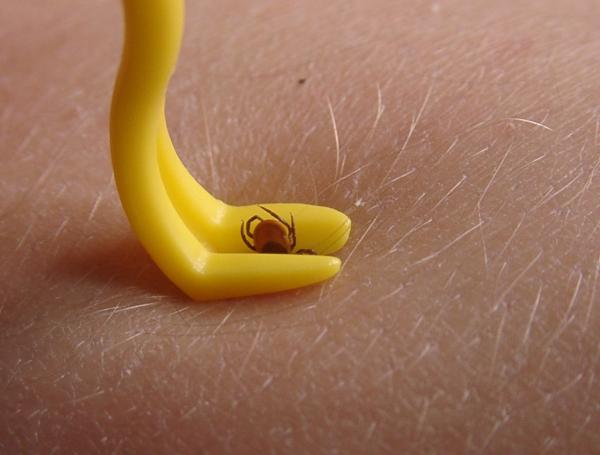 Frühjahr - Zeckenzeit