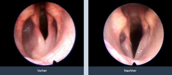 Kehlkopflähmung bei Hund und Katze | Kleintierchirurgie Dr. Kai Morich [KTCDM#PR#2016]