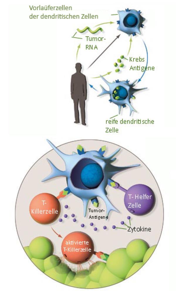 Biologische Krebstherapie - eine echte Alternative?