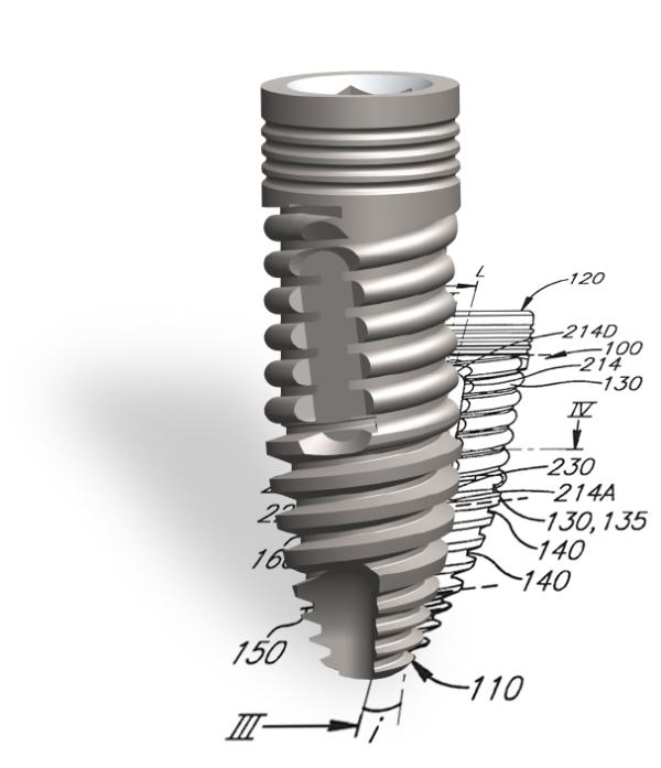 SpiralTech-Implantat ESi: hohe Qualität auf mittlerem Preisniveau
