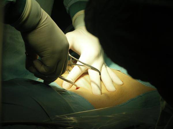 Schlüssellochchirurgie- Mit einem kleinen Schnitt viel erreichen