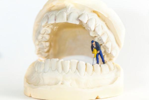 Wurzelbehandlung mit dem Dentalmikroskop in der Praxis Prof. Dhom