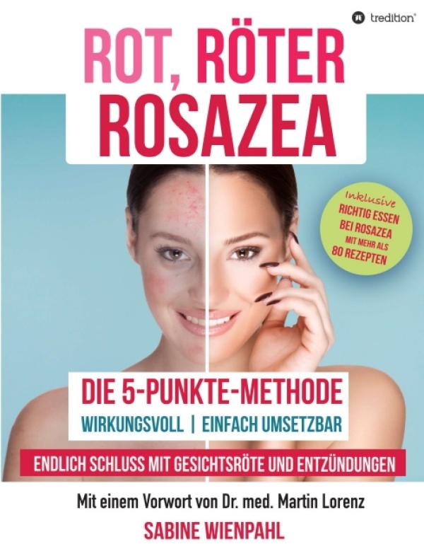 ROT RÖTER ROSAZEA - Wenn das Gesicht in Flammen steht