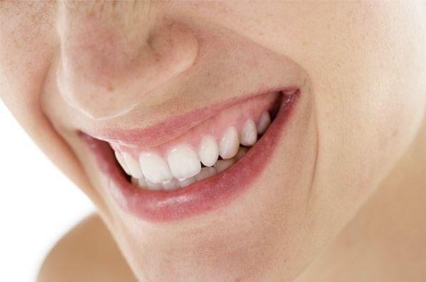Fragen zum Thema Bleaching