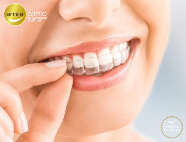Die unsichtbare Zahnspange zur Zahnkorrektur der Smile Clinic in Salzburg zu einem sensationellen Preis
