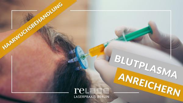 Innovative ärztliche Therapieverfahren bei Haarausfall