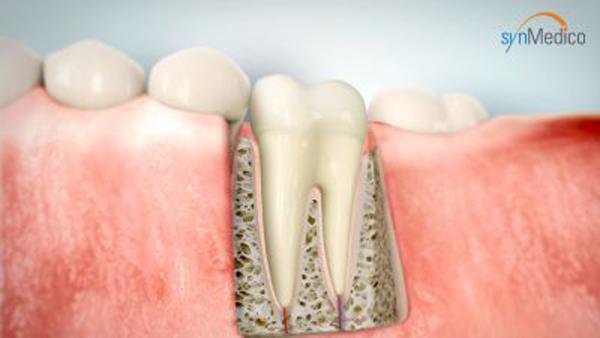 Die Endodontie - ein unterschätzter Bereich der Zahnmedizin, der (Zahn) Leben retten kann.