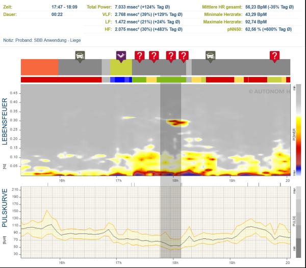 Heart rate variability measurement during a Subtle Body Balance treatment The Subtle Body - Key to a Positive Quality of Life