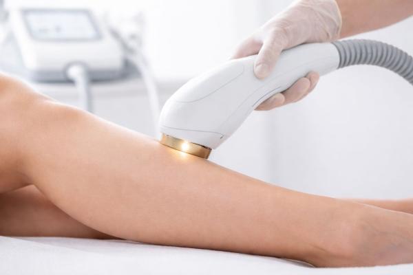 Dauerhafte Haarentfernung bei Hausärzten in Adliswil: SHR und IPL im Vergleich