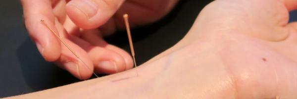 Akupunktur und Traditionelle Chinesische Medizin in Bern: Ganzheitliche Medizin im Dialog der Systeme