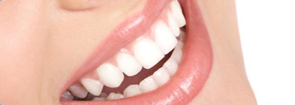 Lächeln ist sexy – Was Dentallabore mit Charisma zu tun haben.